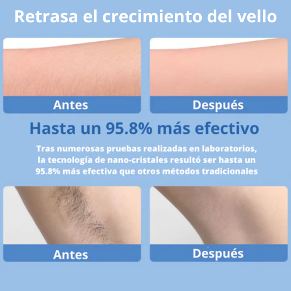 Depiladora PureSkin + Ebook