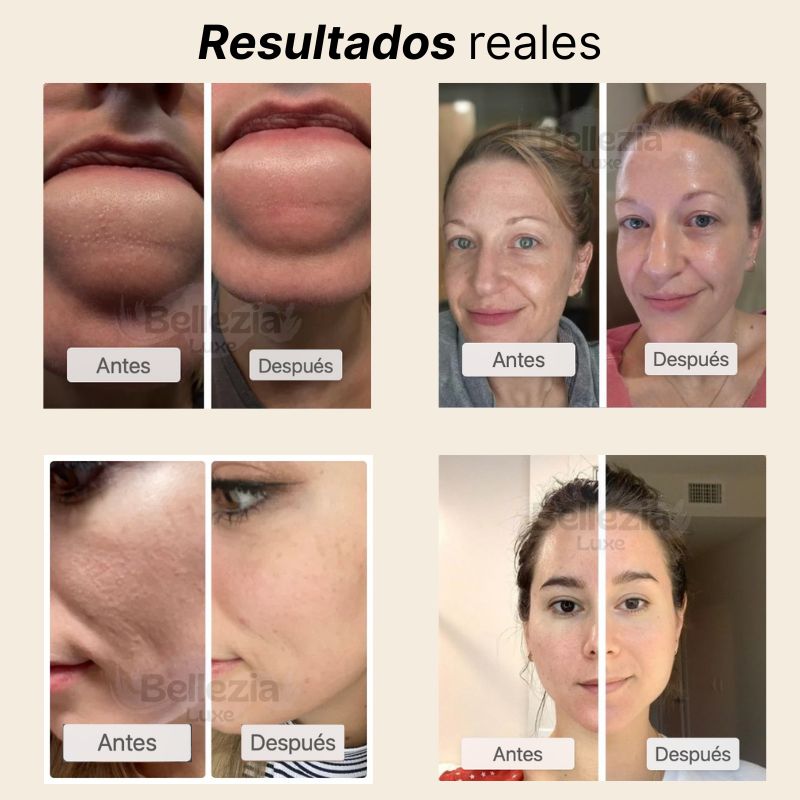 Dr.Melaxin Dúo facial de arroz