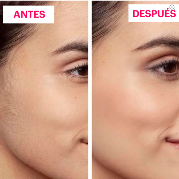 Depiladora facial con luz