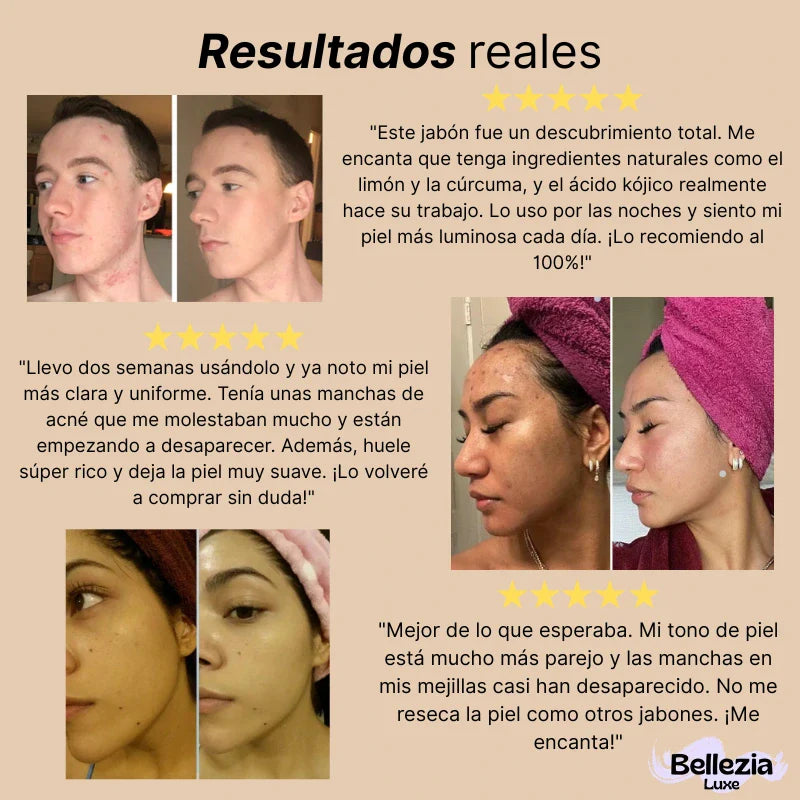 Jabón de Ácido Kójico de Limón y Cúrcuma - Bellezia Luxe